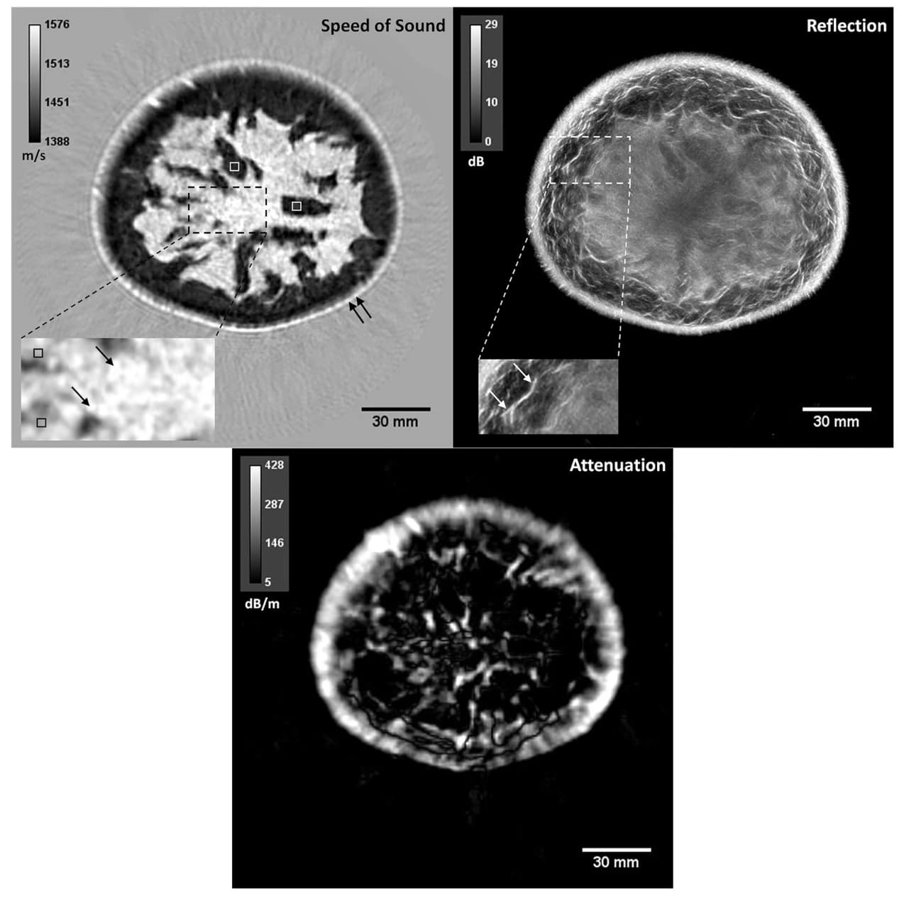 Multimodality QT ultrasound images of a breast showing speed of sound, reflection, and attenuation maps