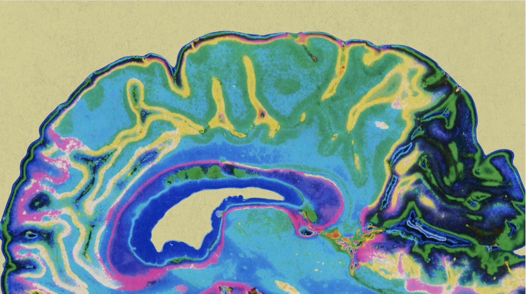 TrueScan Executive MRI Scan — predicting dementia and invisible diseases with MRI