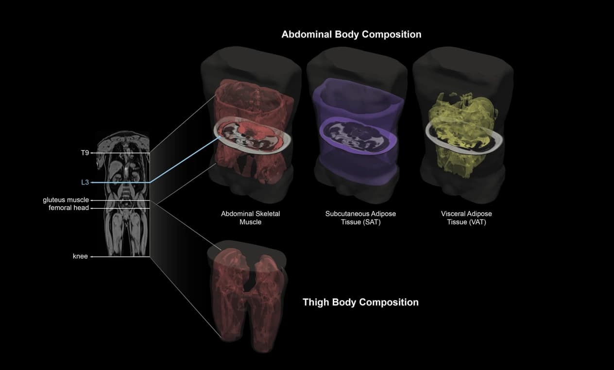 Body Composition scan component breakdown