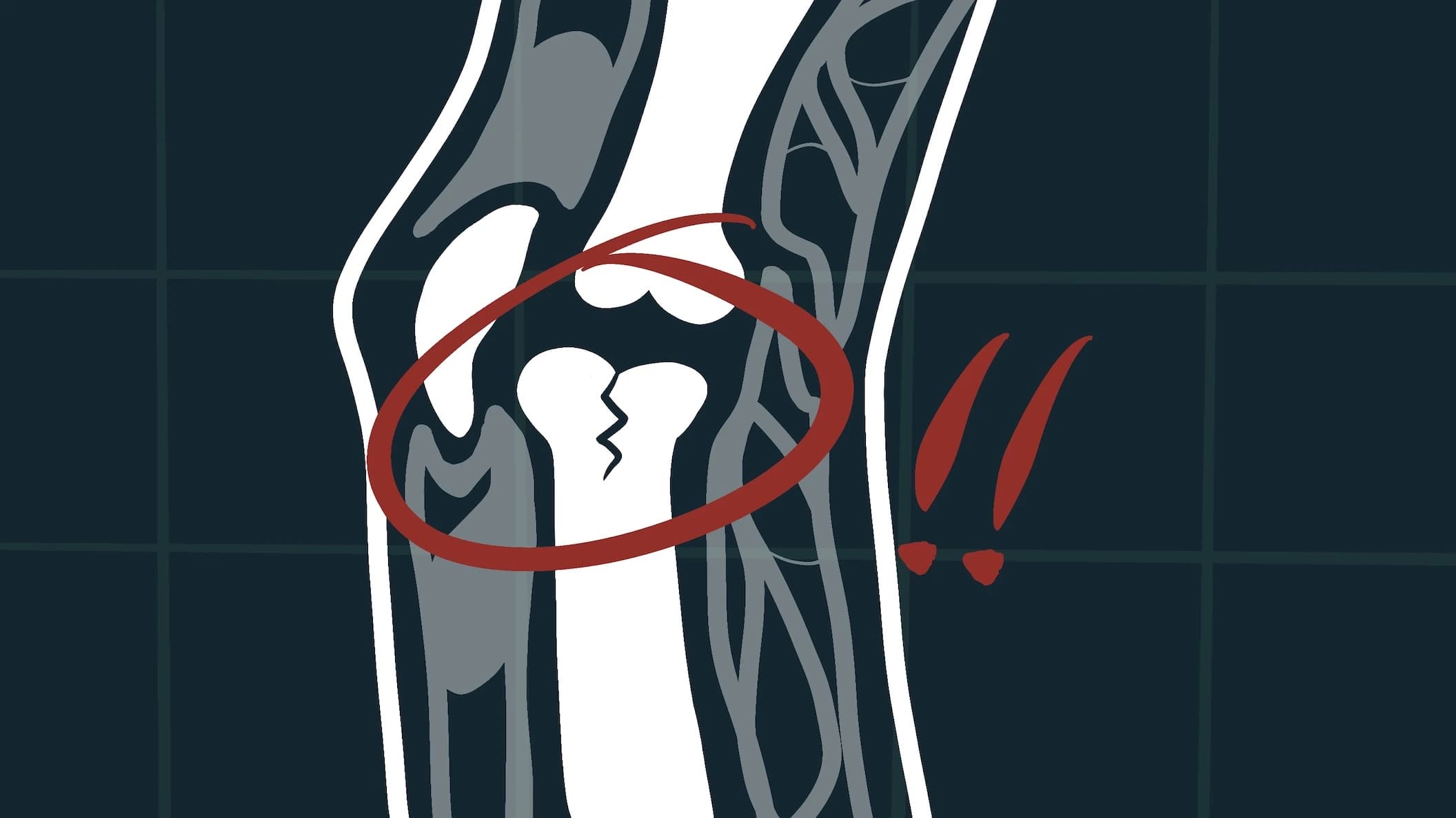 So you think sitting is a luxury? The hidden toll of desk work on your musculoskeletal system