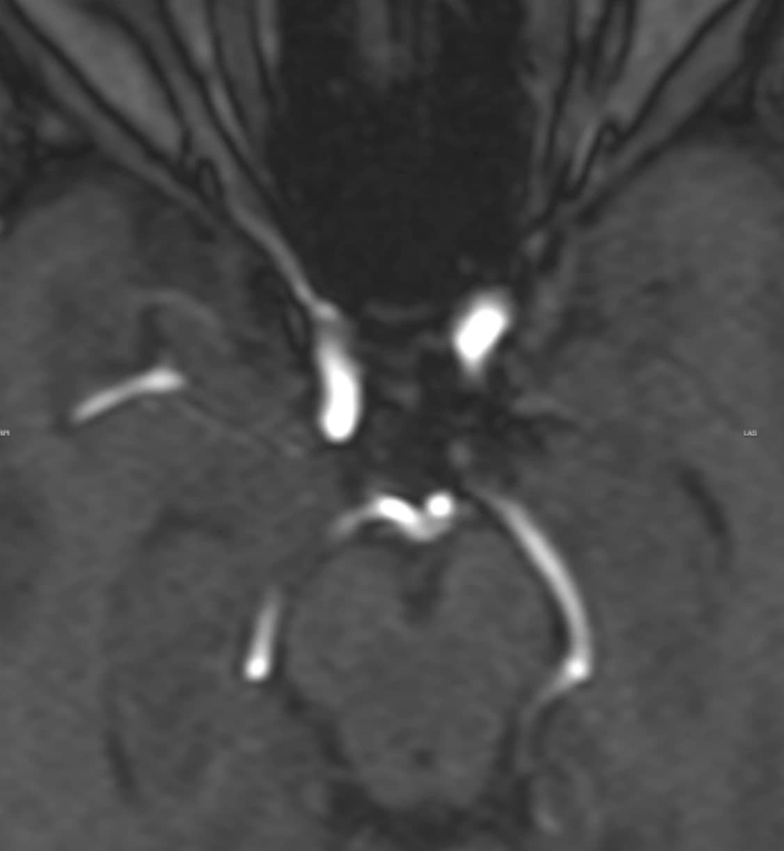 Lynn's imaging report — follow-up after treatment