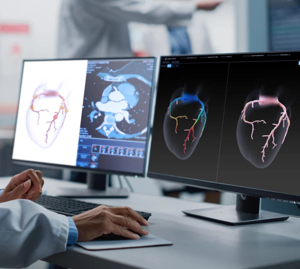 Heartflow Screen Stock