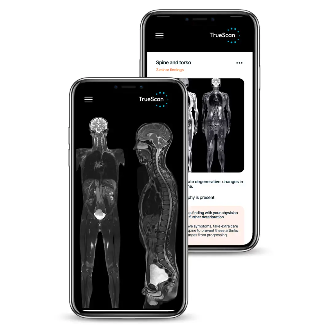 TrueScan Health Report on Phone