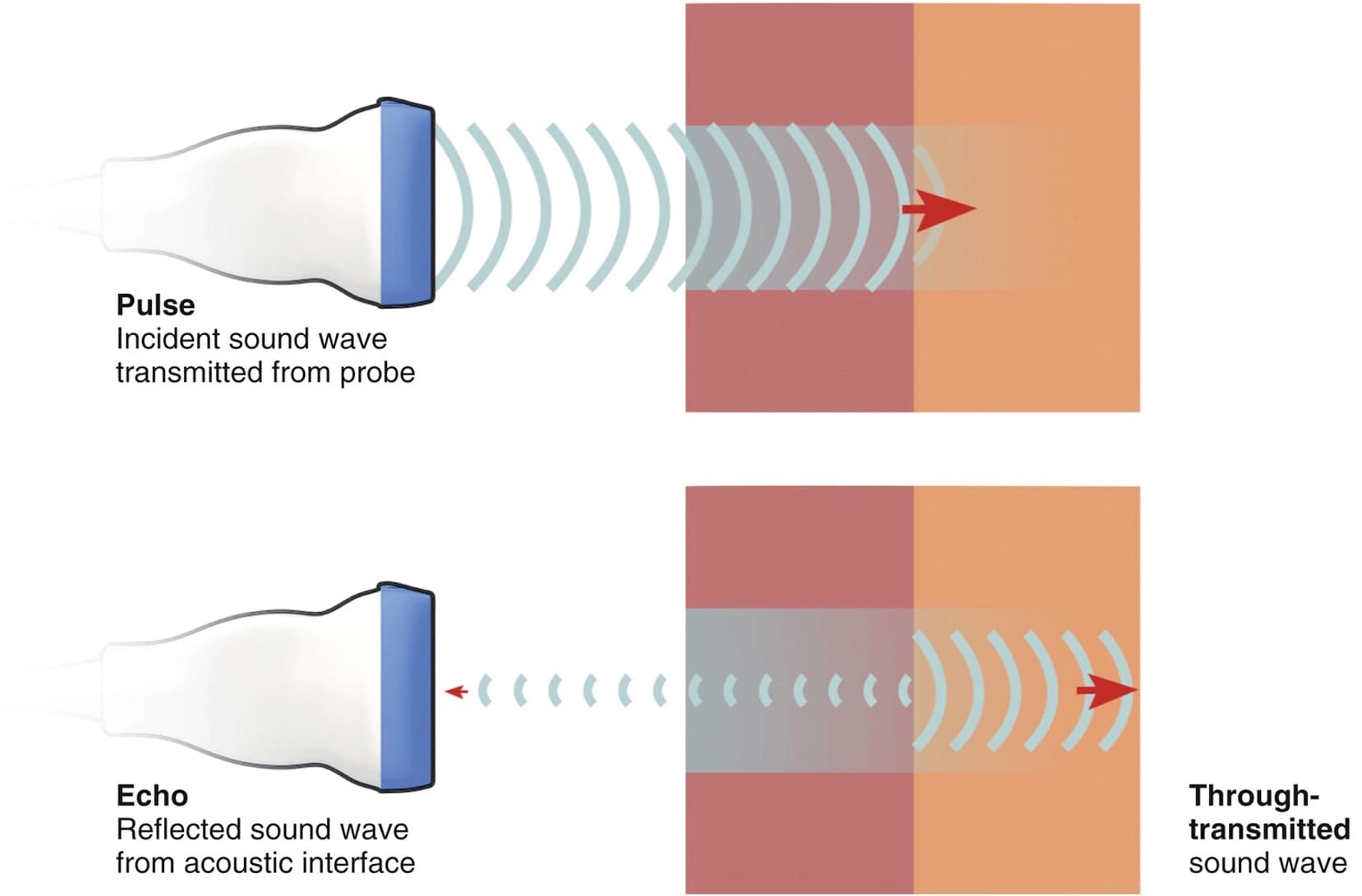 Diagram showing an ultrasound probe emitting a pulse and receiving the echo reflected from an acoustic interface