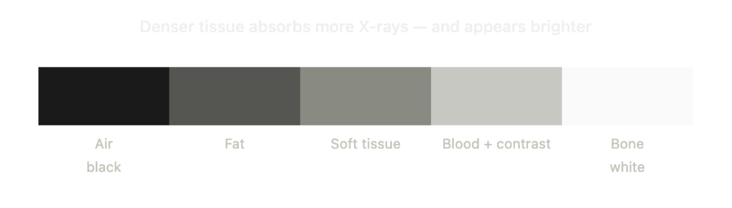 Greyscale density scale for CT running from air in black through fat, soft tissue, and blood with contrast, to bone in white